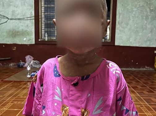 ၅ နှစ်အရွယ်ကလေးကို နှိပ်စက်ခဲ့သည့် မွေးစားမိဘနှစ်ဦးကို ဖမ်းဆီး